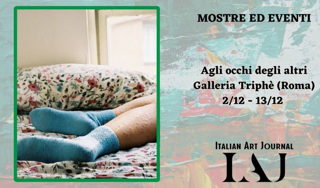 Psoriasi, maschere sociali e corpi vulnerabili: due artiste indagano il prezzo dell'apparire alla Galleria Triphè Di Roma